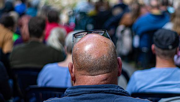 El pelo en sí tiene una estructura sencilla, pero su proceso de formación es increíblemente complejo. (Foto: Pixabay)