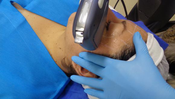 Microson es un tratamiento con ultrasonido focalizado.