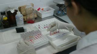Arequipa: primer caso de gripe AH1N1 afectó a joven de 20 años