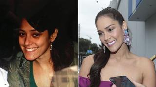 El antes y ahora de los famosos peruanos que pasaron por el quirófano | FOTOS