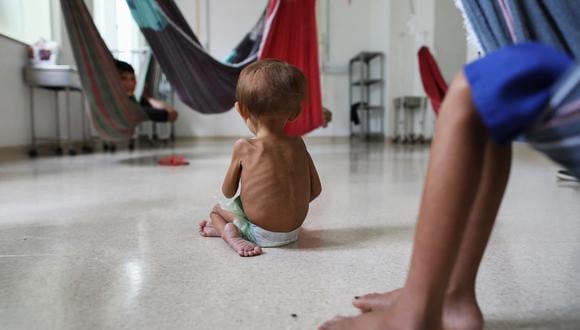 Un niño indígena yanomami desnutrido recibe tratamiento dentro de una sala dedicada a los indígenas del Hospital Infantil Santo Antonio en Boa Vista, estado de Roraima, Brasil, el 27 de enero de 2023. (Foto: MICHAEL DANTAS / AFP)