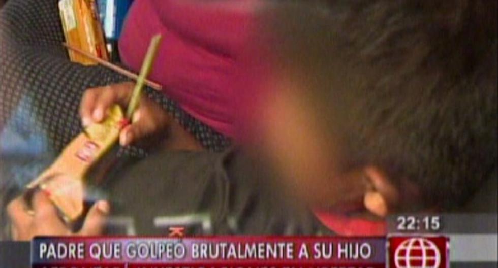 Padre que golpeó a su hijo afrontará el caso en libertad. (Foto: Captura de Canal 4)