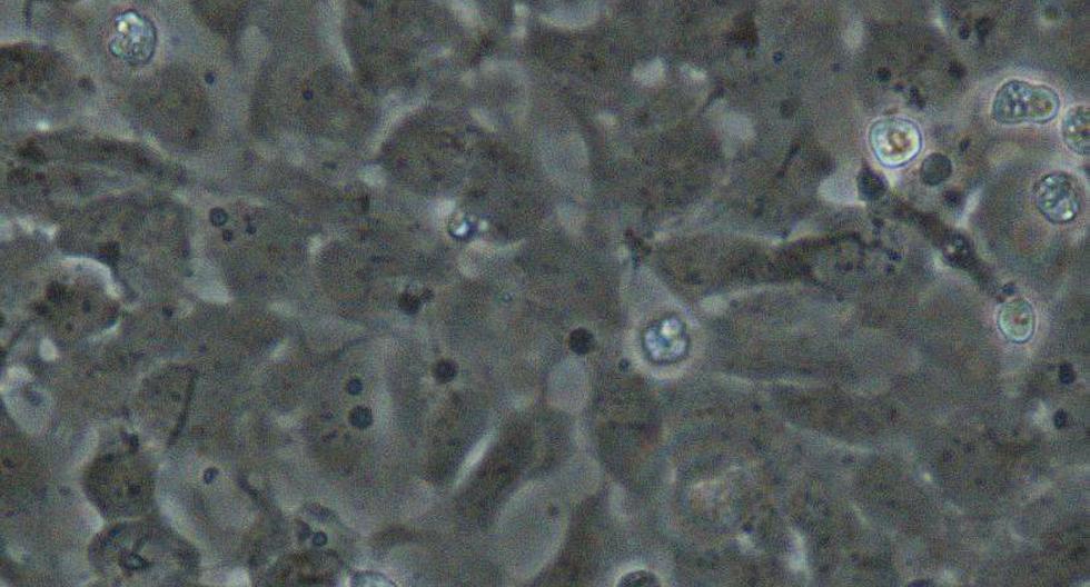 Células madre pueden reemplazar todo tipo de tejidos. (Foto: flickr.com/codonaug)