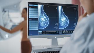 Piden acelerar ley que permite a municipios adquirir mamógrafos y ayudar a detectar casos de cáncer de mama