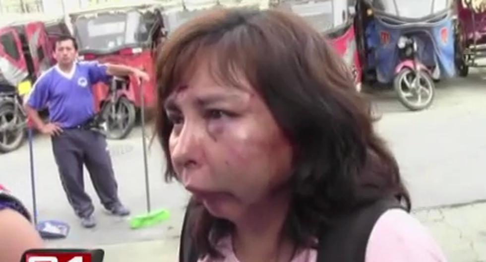 Rosa Quispe acusó a su pareja de propinarle sendos golpes en el rostro. (Foto: Captura de YouTube/Canal 5)