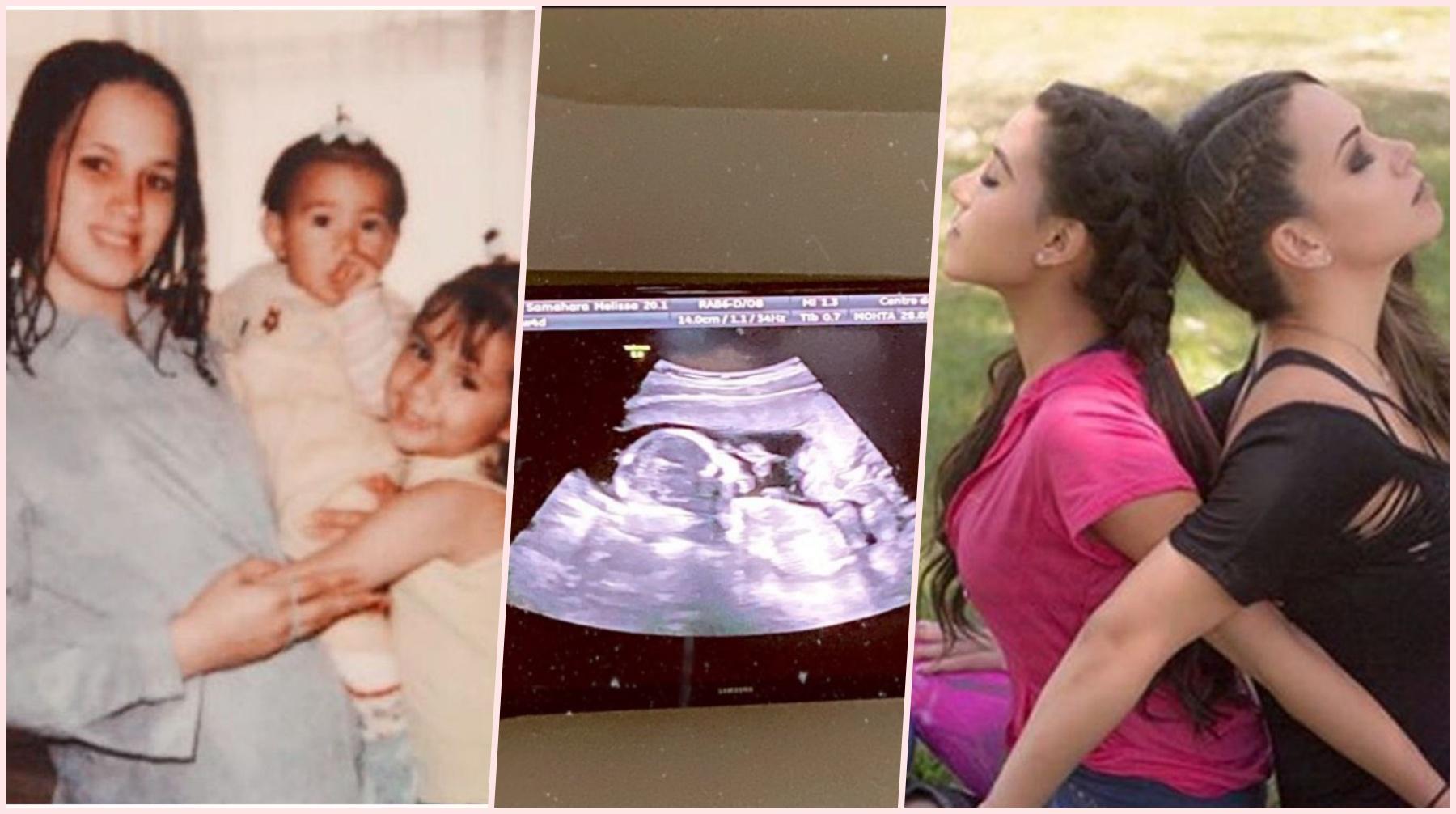 A la izquierda, Melissa Klug junto a sus hijas Samahara y Gianella. A la derecha, Melissa y Samahara. Al centro, la ecografía de Samahara, quien tiene 17 semanas de embarazo. (Foto: Instagram)