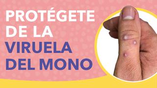 Viruela del mono en Perú: conoce AQUÍ la campaña del Minsa para evitar contagios en lugares nocturnos