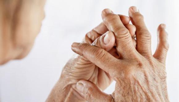 ¿Tronarse los dedos produce artritis? Esto dicen los expertos | En esta nota te contaremos qué es lo que dice la ciencia en torno a este tema, objeto de estudio del ganador del premio Ig Nobel de Medicina; entre otros datos que debes conocer sobre el tema.  (Foto: Difusión)