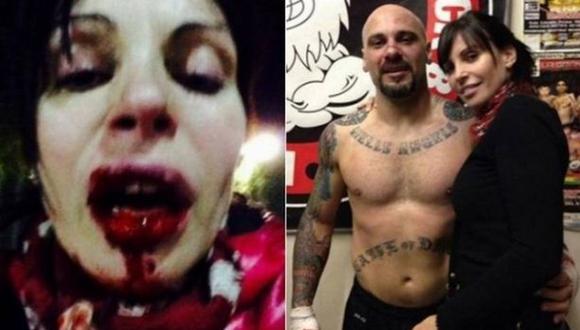 Un boxeador argentino desfiguró a su pareja