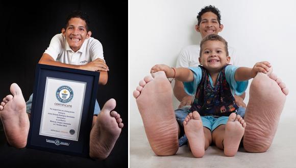 Hombre con pies más grandes del mundo recibe zapatos donados