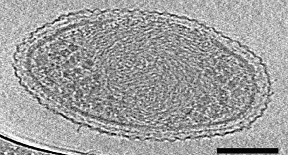 Esta es la bacteria más pequeña de la Tierra. (Foto: RT)