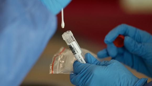Se trata de pruebas que detectan el material genético del coronavirus. (Foto: BUENDIA / AFP)
