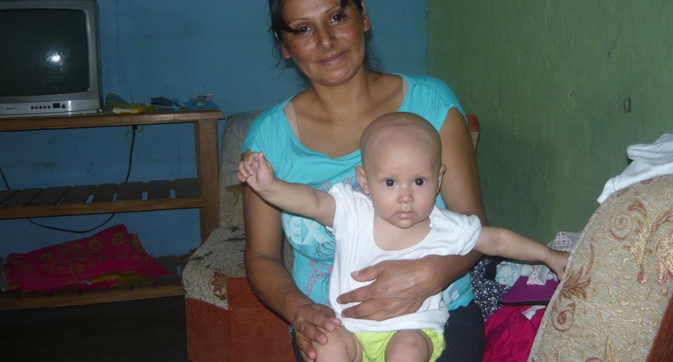 Gia tiene seis meses y padece el tumor de Wilms. (Foto: perú.com)
