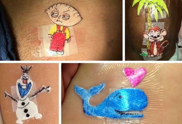 Estos son los dibujos que el doctor Parry hace en los vendajes que luego coloca en las heridas de sus pequeños pacientes | Foto: Facebook / Akron Children's Hospital