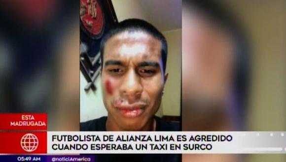 El joven deportista de 21 años se encontraba esperando un taxi en un paradero conocido como Amauta, en el distrito de Surco.(Foto: Captura/América Noticias)