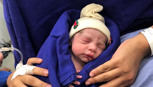 La niña, minutos después de nacer (Foto: Hospital Universitario de Sao Paulo)