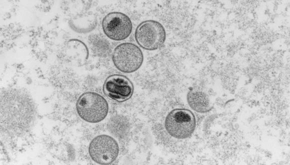 El gobierno federal alemán y el instituto de investigación responsable del control y la prevención de enfermedades, muestra una captura microscópica de electrones de sección ultrafina de la viruela del simio.