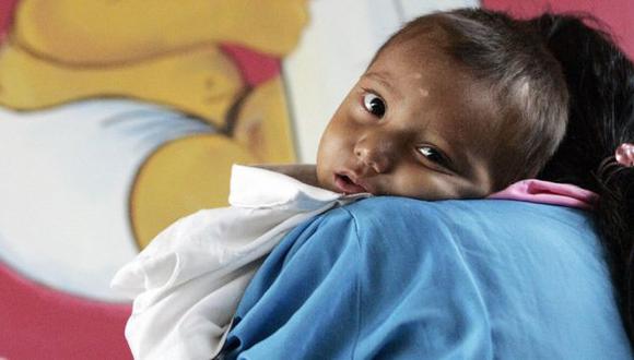 Guatemala lleva años ocupando el primer puesto de desnutrición crónica infantil en América Latina. (Foto: AFP)