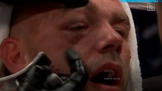 No veía nada: así quedó el ojo de Saunders tras los golpes del Canelo Álvarez | VIDEO