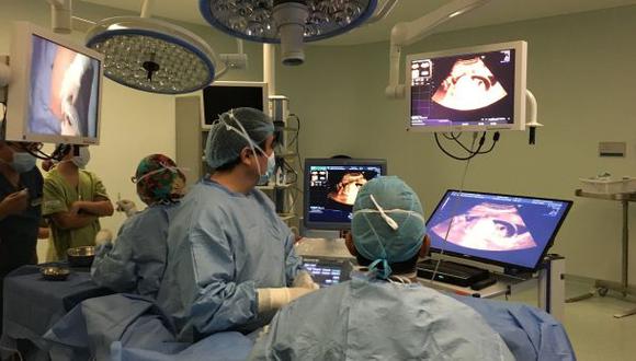 Perú: Realizan primera cirugía fetal para tratar un tumor
