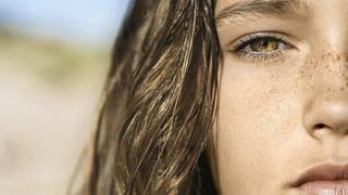 ¿Pecas o no pecas? El mundo de la belleza les abre las puertas