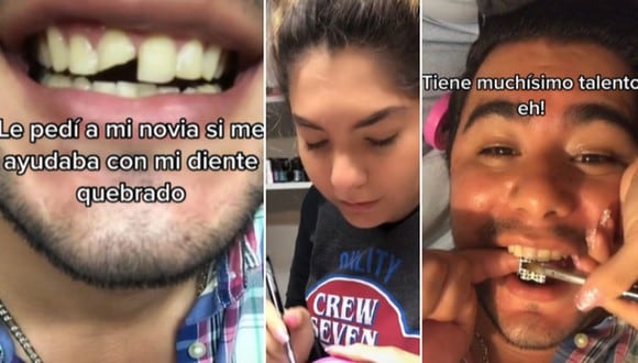 En esta imagen se aprecia al hombre que se le quebró un diente y le pidió a su novia manicurista que se lo ‘arregle’. (Foto: @rewardrew / TikTok)