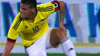 James Rodríguez: mira la jugada de su lesión ante Perú (VIDEO)