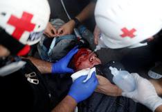 Chile: policía atacó a personal de emergencias mientras atendía a joven que terminó muriendo