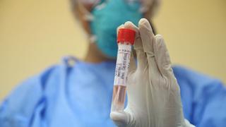 Loreto reporta 9 casos nuevos de coronavirus y la cifra de contagiados se eleva a 52