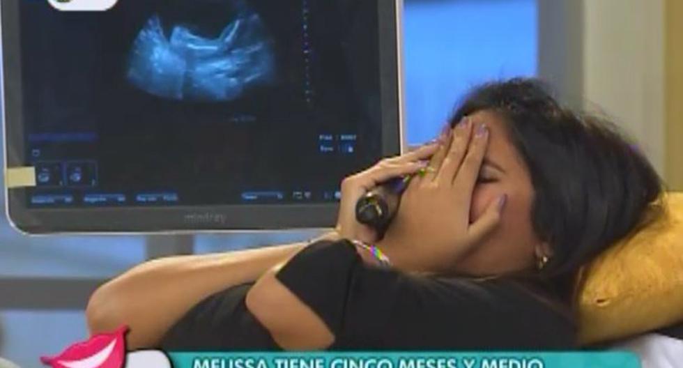 Melissa Paredes llora al enterarse el sexo de su bebé. (Foto: Captura América TV)