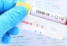 Coronavirus: ¿Debo seguir en cuarentena si sale negativa la prueba PCR?