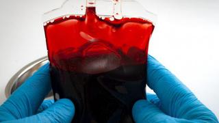 Científicos convierten la sangre tipo A en sangre de donante universal usando bacterias