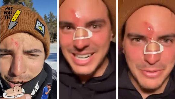 Vadhir Derbez comenta que es bueno esquiando, pero sorprendió al mostrar las lesiones que tuvo tras caída en la nieve. (Foto: Instagram / @aislinnderbez).