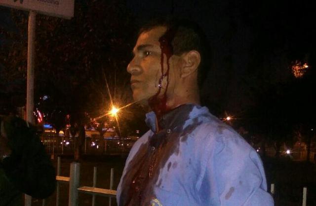 Chofer atacó con vara de fierro a inspector en Av. Javier Prado - 2
