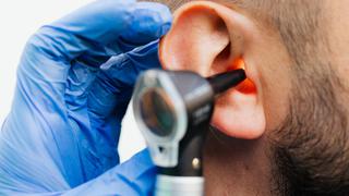 ¿Cómo limpiar mis oídos sin hisopos?