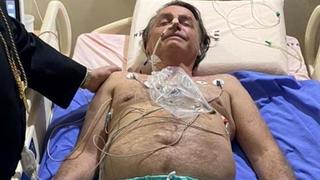 Bolsonaro dice que está mejor y que podría dejar el hospital el viernes