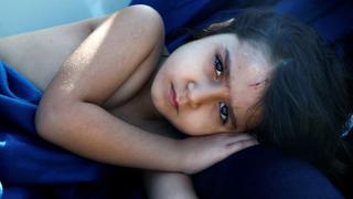 Los niños, inocentes víctimas de la guerra en Siria [CIFRAS]