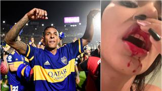 ''Perdí el embarazo por los golpes'': expareja de Villa y su calvario con el futbolista colombiano