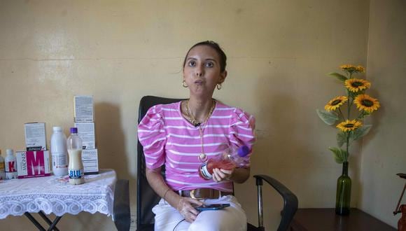 La joven Nathaly Cerda, quien fue diagnosticada con esclerodermia sistémica hace 13 años, habla durante una entrevista con EFE en Managua, Nicaragua. (EFE/Jorge Torres).