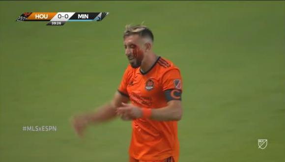 Héctor Herrera sufrió corte y terminó con la cara de sangre en Houston Dynamo vs. Minnesota United. (Captura: MLS)
