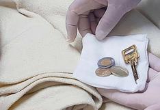 Hombre acude de emergencia a hospital de EsSalud y médicos hallan monedas, una llave y otros objetos en su estómago
