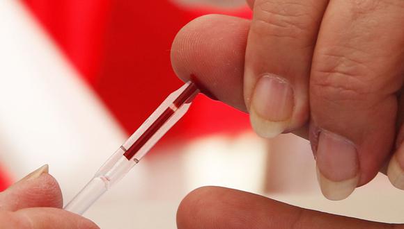 A man undergoes an HIV test during the "Test In The City" operation, a free HIV test in Monaco, on November 25, 2015 in Monaco. AFP PHOTO / VALERY HACHE (Photo by VALERY HACHE / AFP)