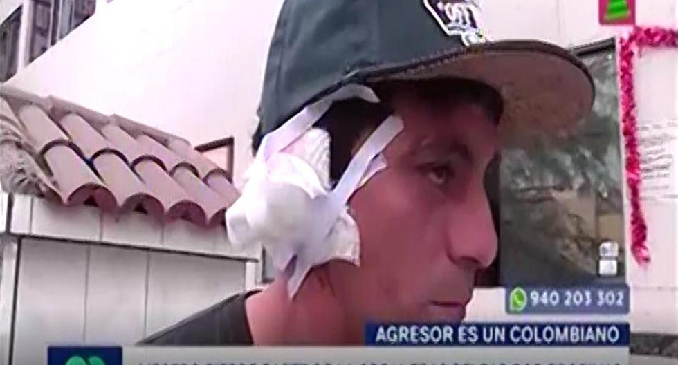 Mesero Martín Sangama Vargas pierde parte de la oreja tras pelear por propinas con su compañero de trabajo. (Captura: Latina)