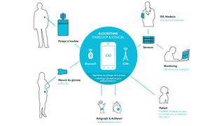 Un páncreas artificial asocia insulina y teléfonos móviles