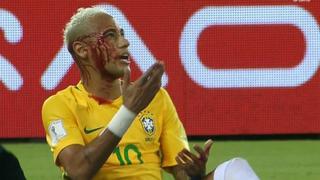 Neymar: así terminó el crack tras golpe de boliviano [VIDEO]