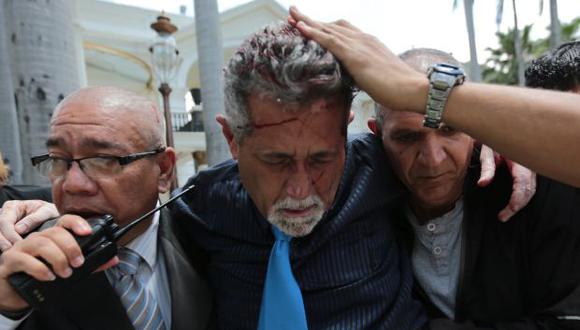 Américo De Grazia es uno de los diputados que resultó herido durante el ataque al Parlamento. (Foto: AP)