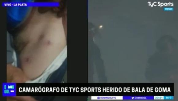 A los exteriores del estadio Juan Carmelo Zerillo, camarógrafo  del diario argentino recibió tres impactos de bala. (Foto: Captura TyC Sports)