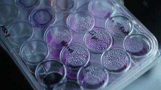Una terapia genética podría ser la clave contra la leucemia