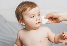 Estas son las causas por las que a tu bebé le salen granitos en la cara