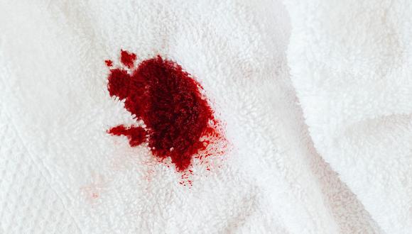 Trucos caseros para eliminar manchas de sangre recientes de la ropa |  Remedios | Hacks | nnda nnni | RESPUESTAS | MAG.